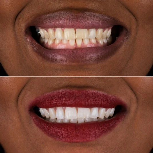 Pâte Dentifrice Longrich au Thé Blanc